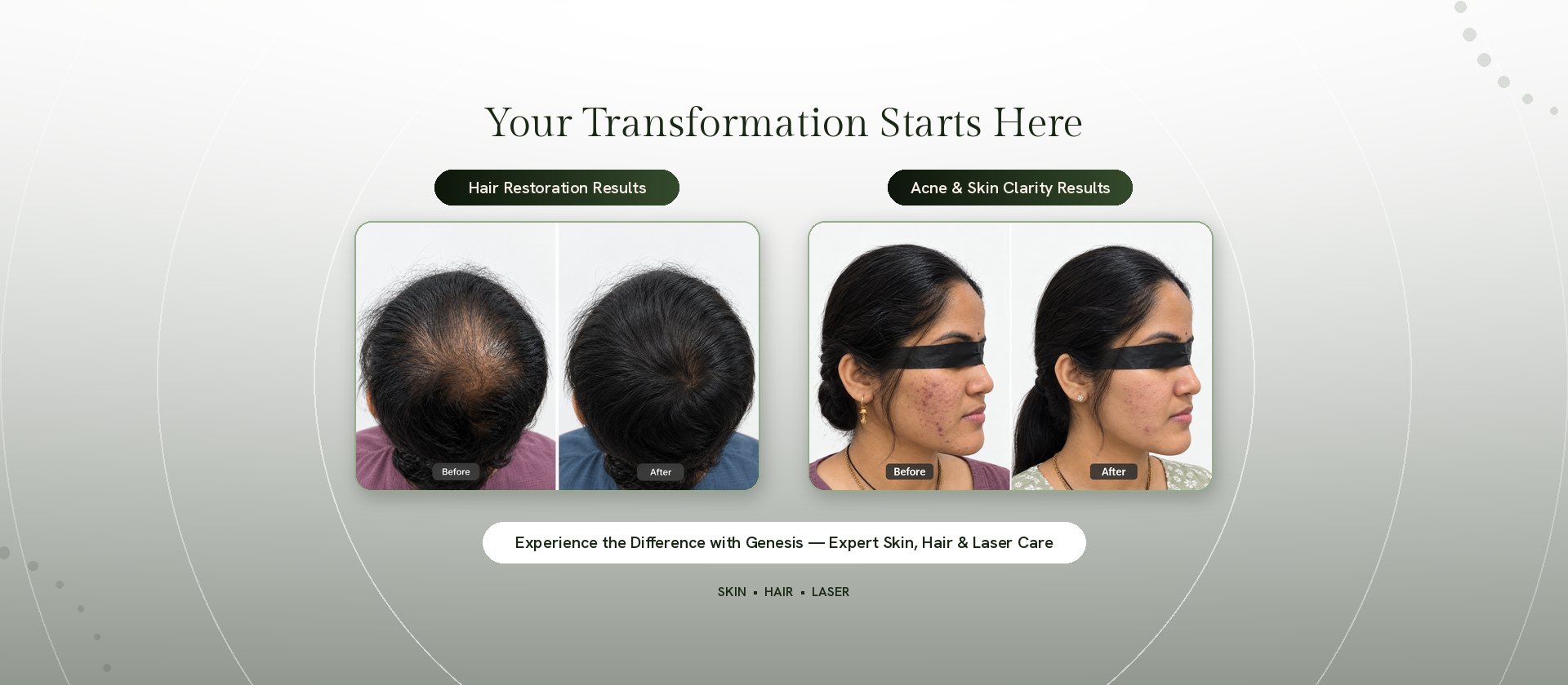 Before and after results for hair restoration and acne treatment at Genesis Dermatology