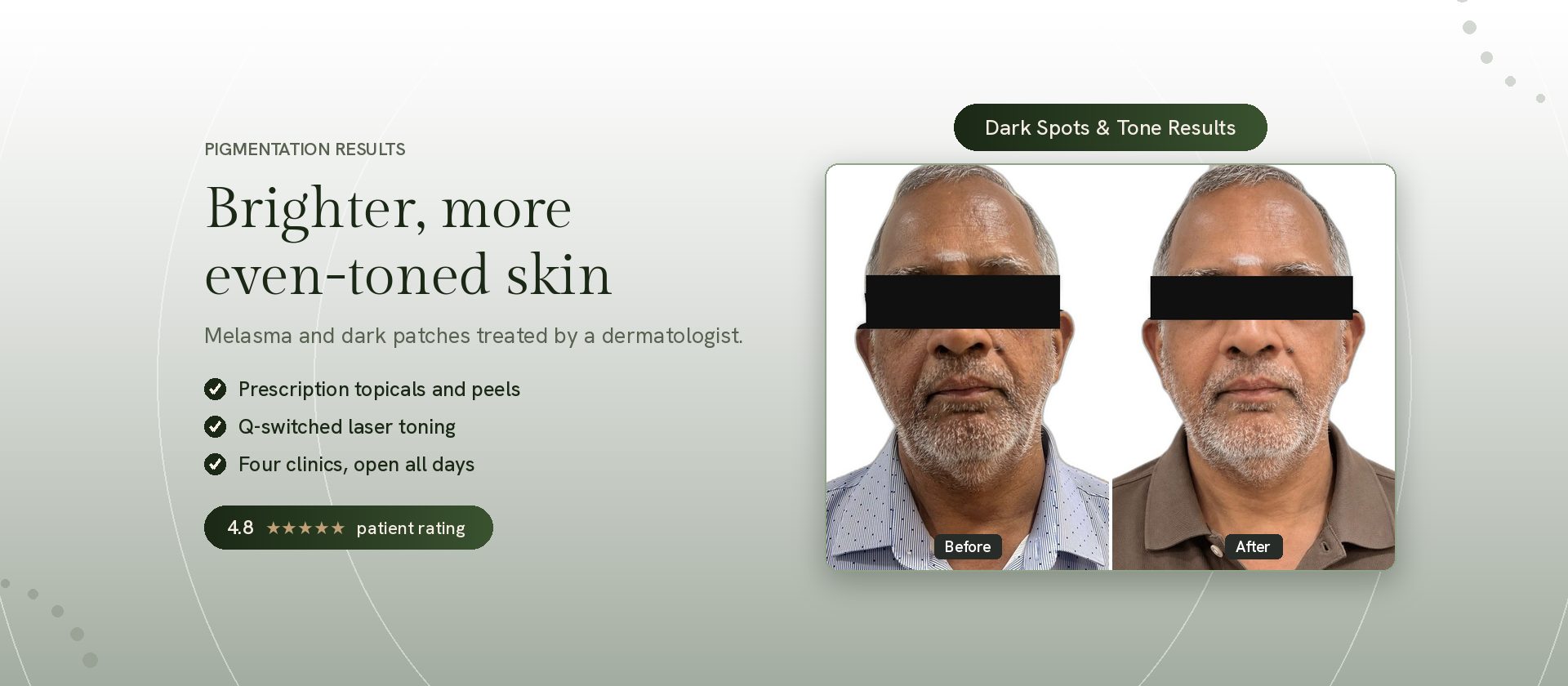 Pigmentation treatment results by a qualified dermatologist at Genesis Dermatology
