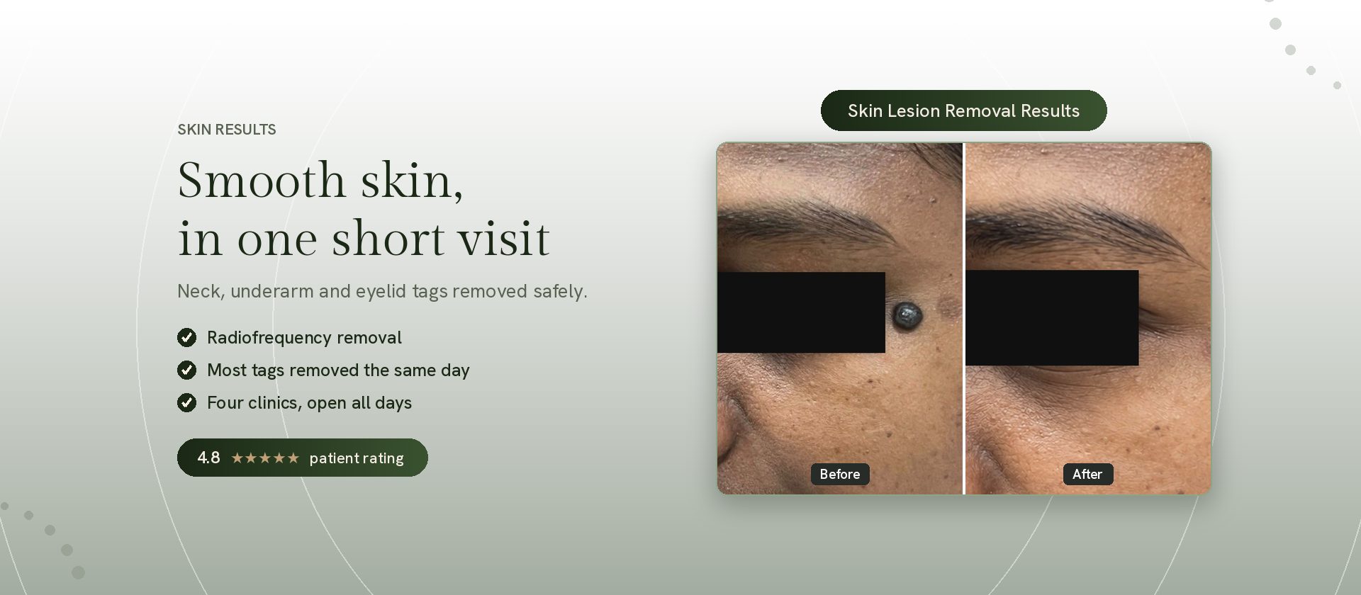 Skin treatment results by a qualified dermatologist at Genesis Dermatology