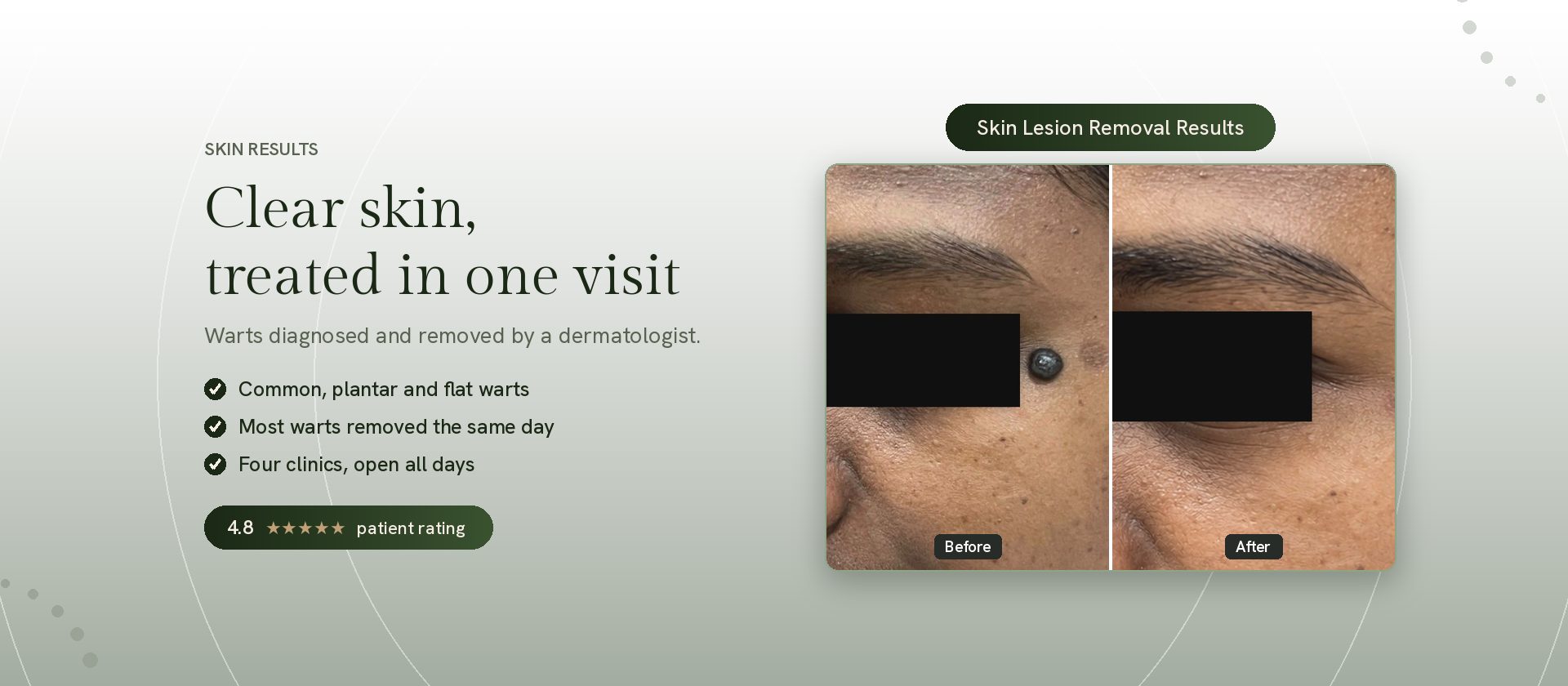 Skin treatment results by a qualified dermatologist at Genesis Dermatology