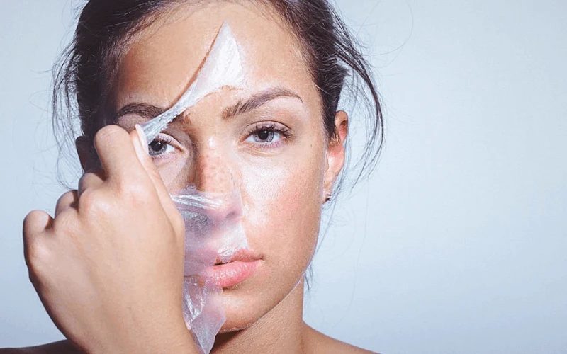 Chemical peel dermatologist in Chennai applying a peel at the clinic