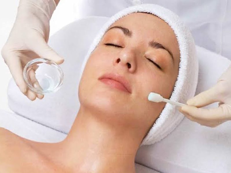 Chemical peel at Genesis Dermatology, Chennai