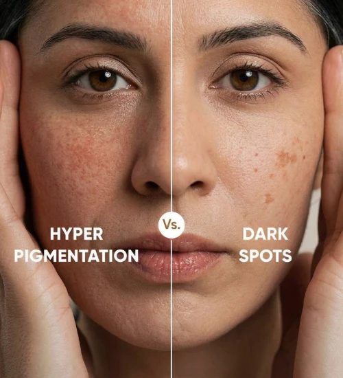 Inside our pigmentation clinic in Chennai, where a dermatologist consults seven days a week
