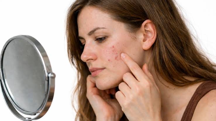 Pigmentation doctor in Chennai examining facial pigmentation under dermoscopy